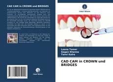 CAD CAM in CROWN und BRIDGES的封面