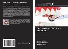 Capa do livro de CAD CAM en CROWN y BRIDGES 