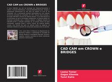 CAD CAM em CROWN e BRIDGES的封面