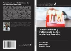 Buchcover von Complicaciones y tratamiento de los implantes dentales