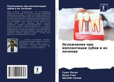 Capa do livro de Осложнения при имплантации зубов и их лечение 