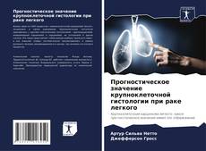 Bookcover of Прогностическое значение крупноклеточной гистологии при раке легкого