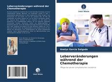 Borítókép a  Leberveränderungen während der Chemotherapie - hoz