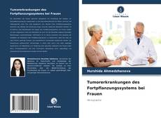 Tumorerkrankungen des Fortpflanzungssystems bei Frauen的封面