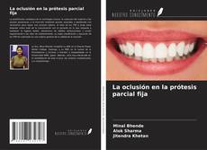Bookcover of La oclusión en la prótesis parcial fija