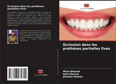 Occlusion dans les prothèses partielles fixes kitap kapağı