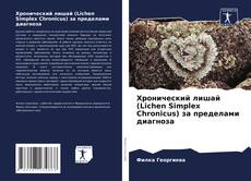 Buchcover von Хронический лишай (Lichen Simplex Chronicus) за пределами диагноза