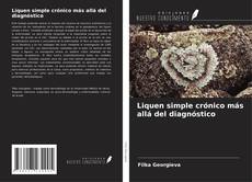 Bookcover of Liquen simple crónico más allá del diagnóstico