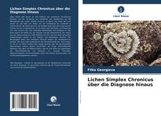 Bookcover of Lichen Simplex Chronicus über die Diagnose hinaus