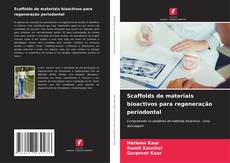 Buchcover von Scaffolds de materiais bioactivos para regeneração periodontal