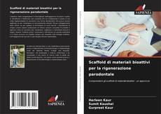 Bookcover of Scaffold di materiali bioattivi per la rigenerazione parodontale