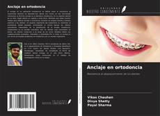 Capa do livro de Anclaje en ortodoncia 