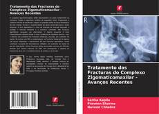 Bookcover of Tratamento das Fracturas do Complexo Zigomaticomaxilar - Avanços Recentes