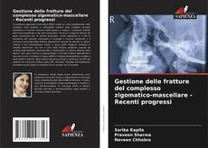 Gestione delle fratture del complesso zigomatico-mascellare - Recenti progressi kitap kapağı
