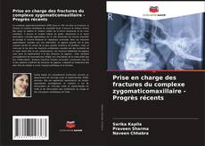 Bookcover of Prise en charge des fractures du complexe zygomaticomaxillaire - Progrès récents