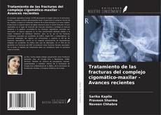 Bookcover of Tratamiento de las fracturas del complejo cigomático-maxilar - Avances recientes