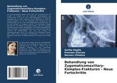 Behandlung von Zygomaticomaxillary-Komplex-Frakturen - Neue Fortschritte的封面