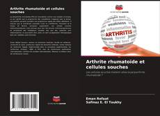 Couverture de Arthrite rhumatoïde et cellules souches