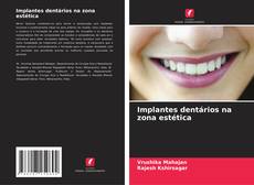 Buchcover von Implantes dentários na zona estética