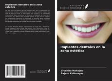 Bookcover of Implantes dentales en la zona estética