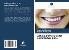 Couverture de Zahnimplantate in der ästhetischen Zone