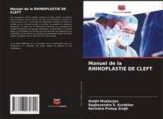 Buchcover von Manuel de la RHINOPLASTIE DE CLEFT