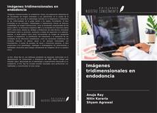 Bookcover of Imágenes tridimensionales en endodoncia