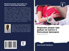 Bookcover of Ведение родов при рубце на матке в больнице Цикадзи