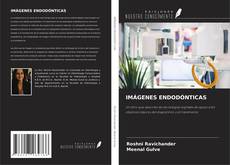 IMÁGENES ENDODÓNTICAS kitap kapağı