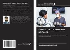 FRACASO DE LOS IMPLANTES DENTALES kitap kapağı