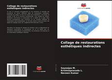 Collage de restaurations esthétiques indirectes的封面