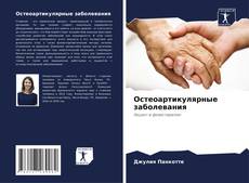 Bookcover of Остеоартикулярные заболевания