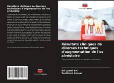 Buchcover von Résultats cliniques de diverses techniques d'augmentation de l'os alvéolaire