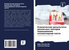 Bookcover of Клинические результаты различных методов наращивания альвеолярной кости