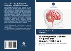 Bookcover of Bildanalyse des Gehirns mit parallelen Computertechniken