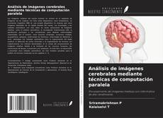 Bookcover of Análisis de imágenes cerebrales mediante técnicas de computación paralela