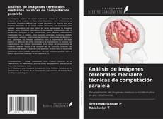 Couverture de Análisis de imágenes cerebrales mediante técnicas de computación paralela