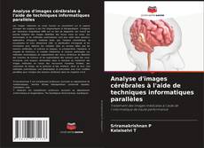 Buchcover von Analyse d'images cérébrales à l'aide de techniques informatiques parallèles