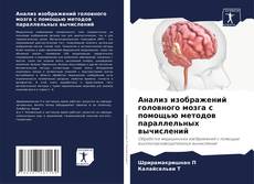 Bookcover of Анализ изображений головного мозга с помощью методов параллельных вычислений