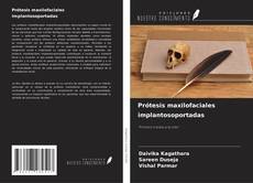 Bookcover of Prótesis maxilofaciales implantosoportadas