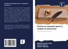 Челюстно-лицевой протез с опорой на имплантат kitap kapağı