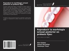 Buchcover von Reproducir la morfología oclusal posterior en prótesis fijas: