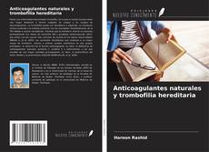 Borítókép a  Anticoagulantes naturales y trombofilia hereditaria - hoz