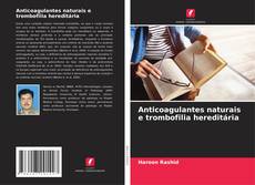Bookcover of Anticoagulantes naturais e trombofilia hereditária