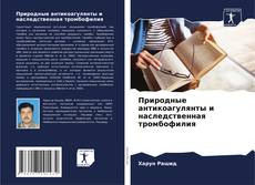 Buchcover von Природные антикоагулянты и наследственная тромбофилия
