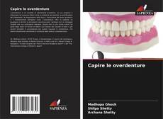 Bookcover of Capire le overdenture