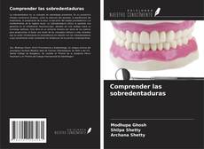 Capa do livro de Comprender las sobredentaduras 