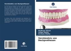 Couverture de Verständnis von Deckprothesen