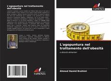 Bookcover of L'agopuntura nel trattamento dell'obesità