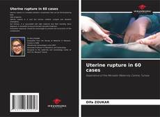 Buchcover von Uterine rupture in 60 cases